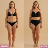 Monica — CORRECTIVE U-WIRE BIKINI